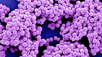 Multidrug resistant Staphylococcus aureus, or MRSA, bacteria