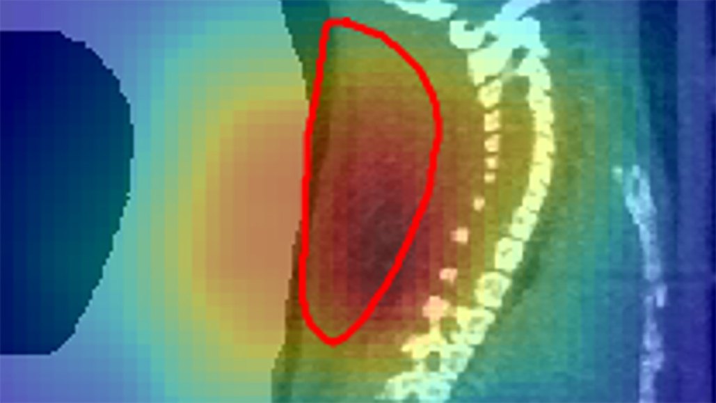 An image shows a mouse's spine overlaid with colors indicating radioactive decays. The region of highest activity overlaps with a tumor region circled in red.